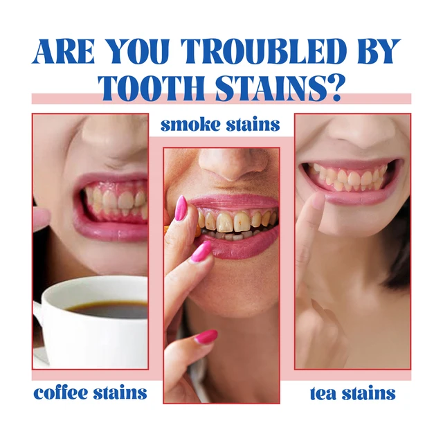 Sp-6 Probiotics Brightening Toothpaste Cleansing Tartar Remove Dental Plaque Fresh Breath Prevent Periodontitis Oral Teeth Care 3