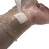 50pcs/set Square Shape Band Aid PU Waterproof Wound Plasters Transparent Patch for First Aid Adhesive Woundplast Tape 5