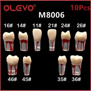 OLEVO 10 Pcs Dental RCT Endo Teeth Model Endodontic Root Canal Block Pulp Cavity Resin Study Practice Endodontic Training M8006