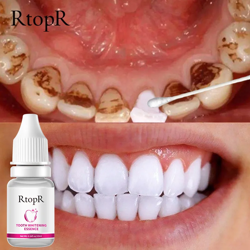 

RtopR Teeth Whitening Serum Remove Plaque Stains Tooth Bleaching Care Gel Oral Hygiene Cleaning Fresh Bad Breath Dental Tools