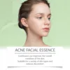 Azelaic Acid Serum Acne Remover Shrinking Pore Invisible Oil Control Brighten Soothing Firm Moisturizing Facial Essence Liquid 4
