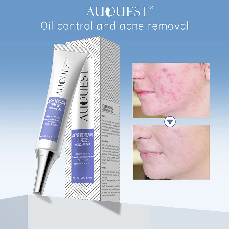 Auquest Oil Control Crema Viso Tea Tree Gel Riparatore Sensibile All'Olio Creme Idratanti Ad Assorbimento Rapido Cura Della Pelle Del Viso