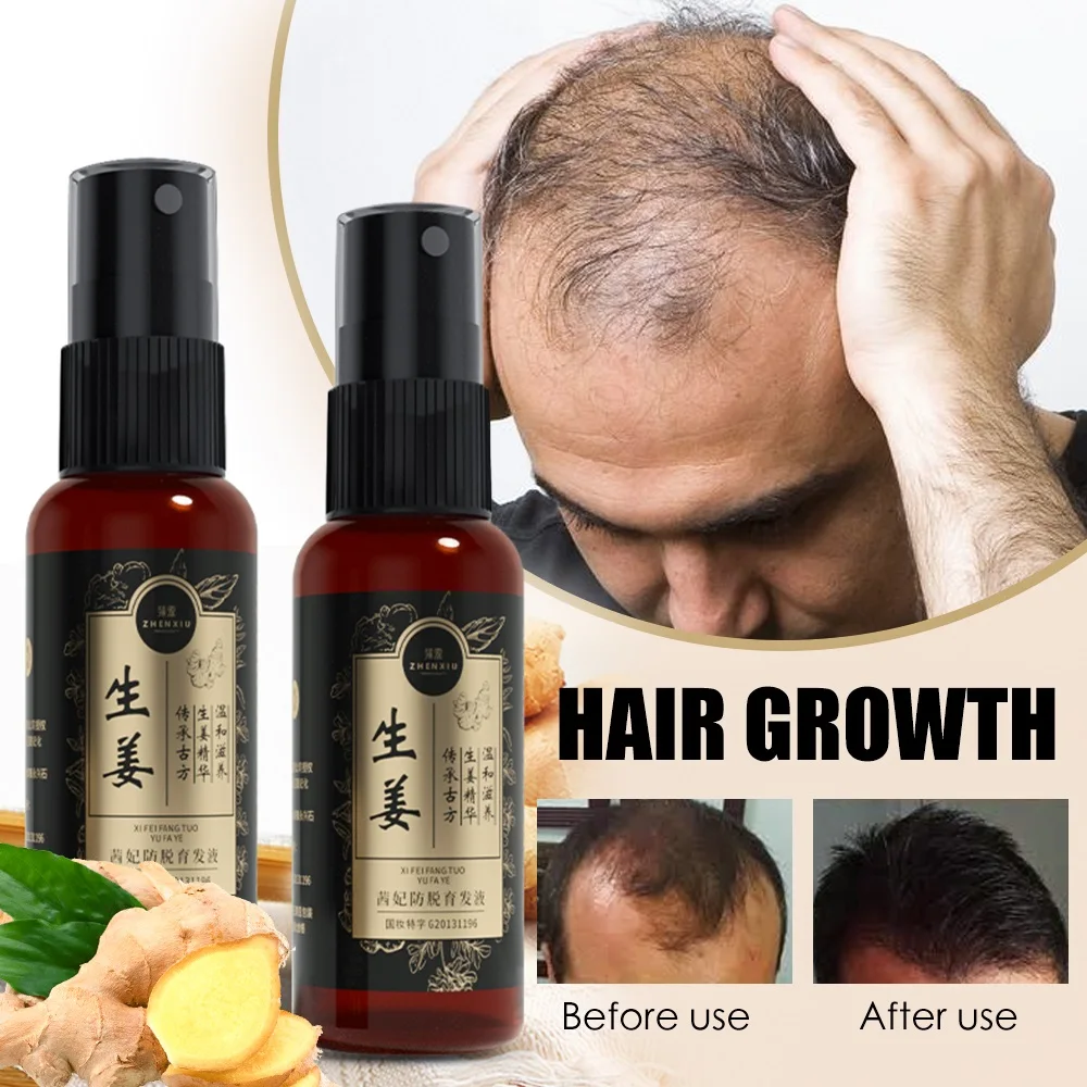 

Спрей для роста волос HAIRCUBE с маслом против выпадения волос сыворотка против облысения имбирь натуральный Уход за волосами для мужчин и женщин 30 мл