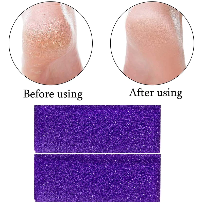 3/5pcs Reusable Foot Pumice Sponge Stones Foot Care Callus Exfoliate Hard Skin Remover Pedicure Scrubber Scrub Manicure Tools 3