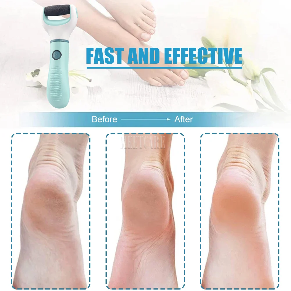 Electric Foot Grinder and Callus Remover for Safe Pedicure and Foot Care