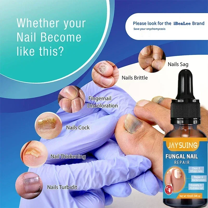 Nail Care Kit Enhanced Fungal Nail Eliminator for Fungus and Yellow Nails 99886653