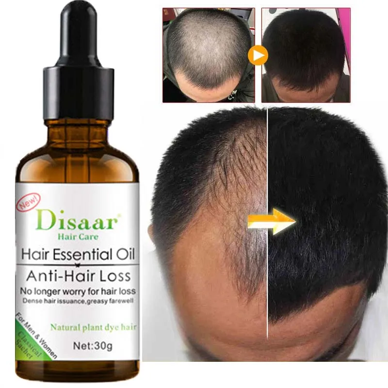 Hair Growth Essential Oil Natural Anti Hair Loss Products Fast Promote