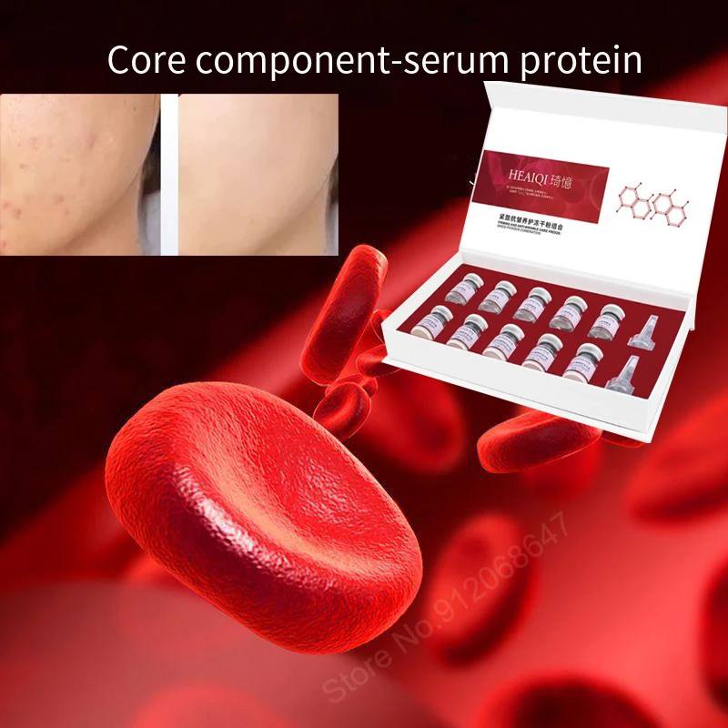 세럼 단백질 에센스 콜라겐 얼룩 유형 어린이 얼굴 물 빛 액체 제대혈 운동 에너지 동결 건조 분말 