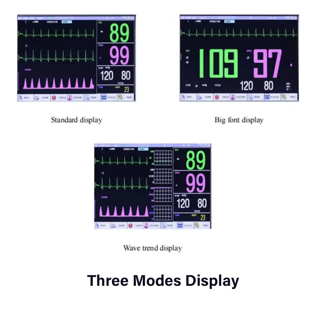 Veterinary Monitor Pet Vital Signs Monitor 7 inch screen 6-Parameters Patient