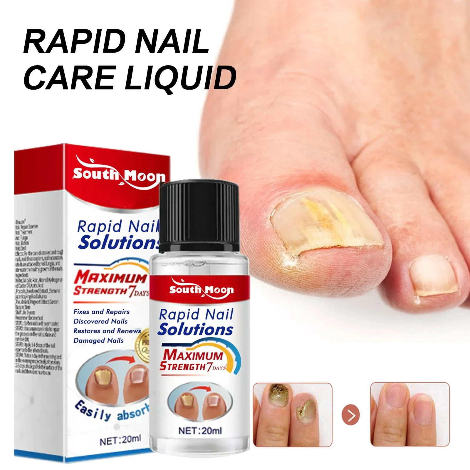 Nail Fungal Treatment Serum Anti Infection Onychomycosis Paronychia Rapid Repair Gel Toe Nail Fungal Fast Removal Hand Foot Care 1pc instantly eye bag removal eye cream long lasting wrinkles lines puffiness serum dark remover care fine effect eyes circle