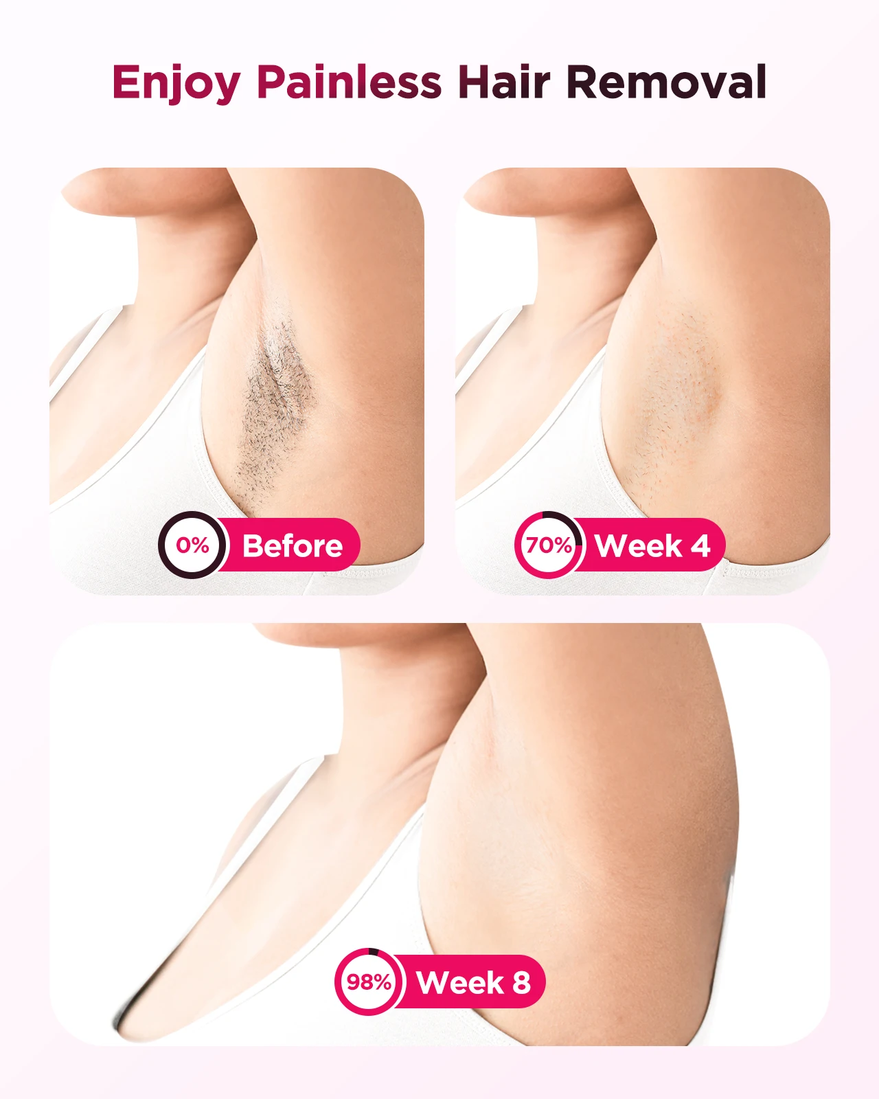 Dispositivo di epilazione laser IPL con raffreddamento a ghiaccio 3 in 1, indolore, fotoepilatore da 16J, trattamento permanente per tutto il corpo a casa per uomo_voghion.com
