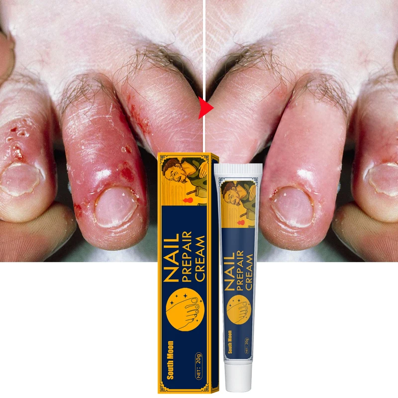 Foot Cream Nourishing Foot Care Remove Beriberi, Foot Odor, Itchy Feet