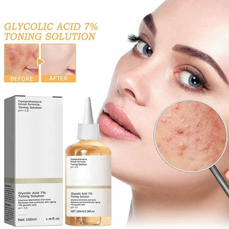 Toner Remove Acne Glycolic Acid 7% Fade Acne Marks Improve Skin Hydrating Whitening Moisturize Toning