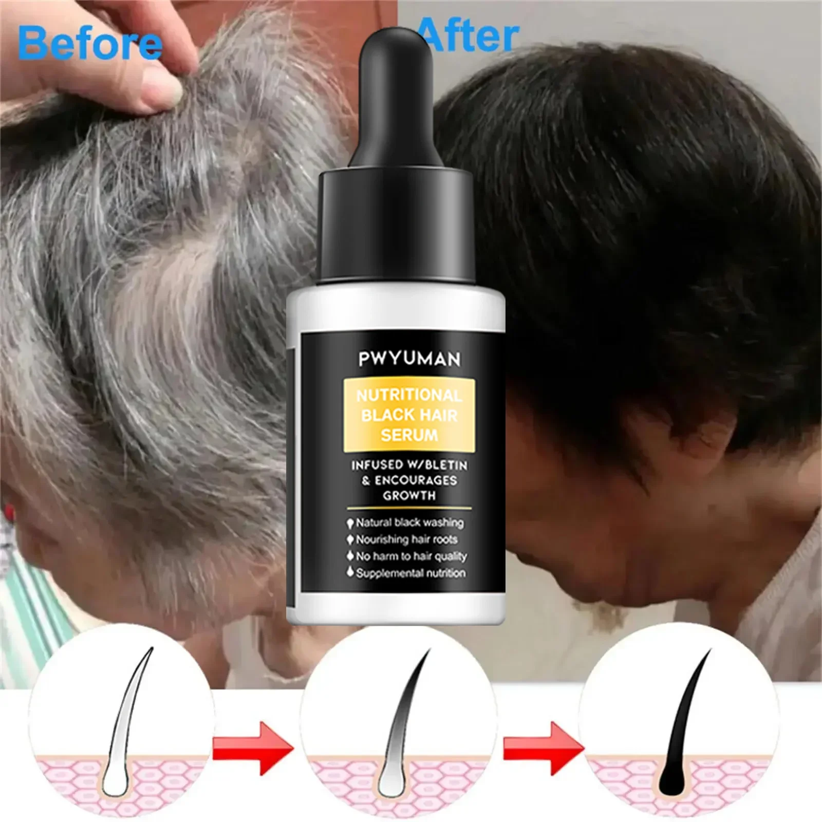 

Gray White Hair Treatment Serum White Black Natural Color Hair Growth Oils Fast Regrowth Anti Hair Loss Beauty Health Women Men