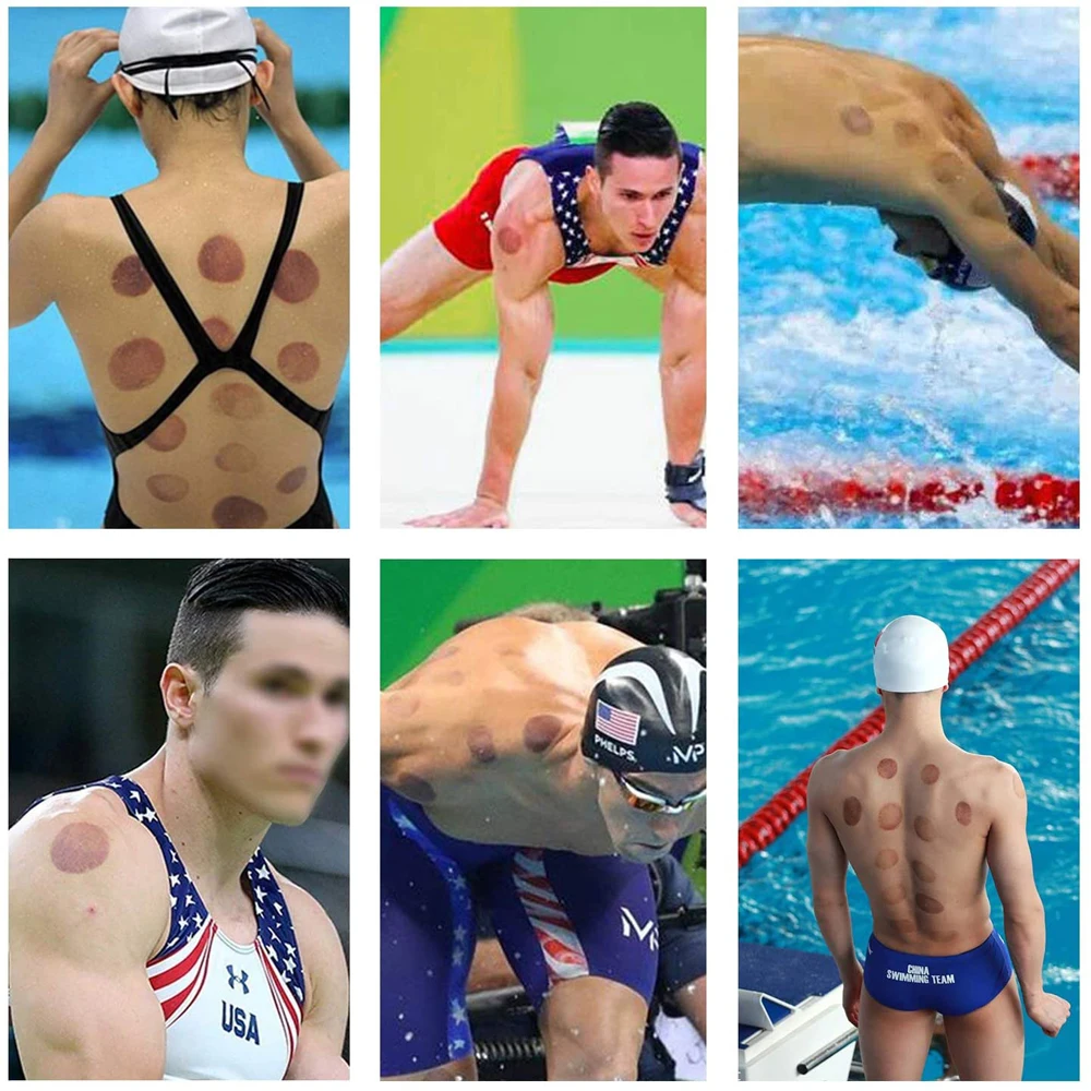 Conjuntos de terapia de ventosas, Hijama, ventosas de vacío, 24