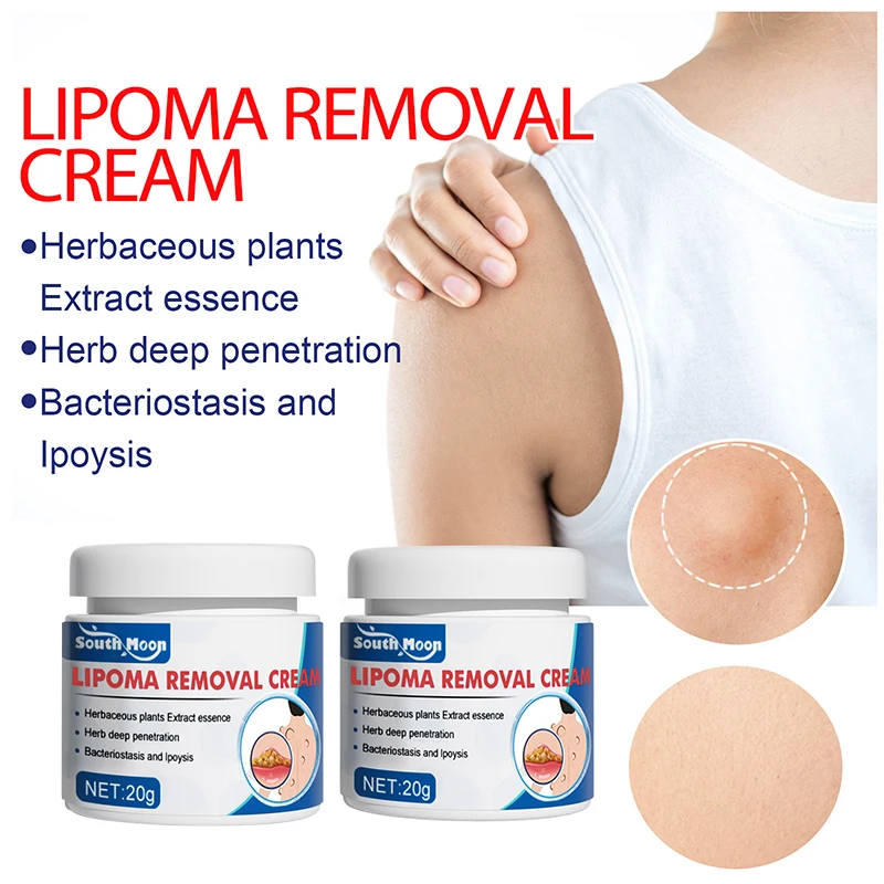 Lipoma Removal Cream 12pcs/20g Antitumor Remove Fat Lump Ointment Nodular Discomfort Skin Cyst Swelling Pain Relief Plaster