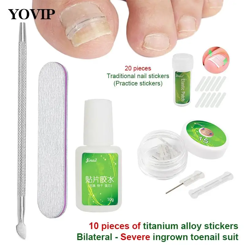 

25/30Pcs 13-19mm Nail Correction Stickers Ingrown Toenail Corrector Patches Paronychia Treatment Recover Care Pedicure Tools
