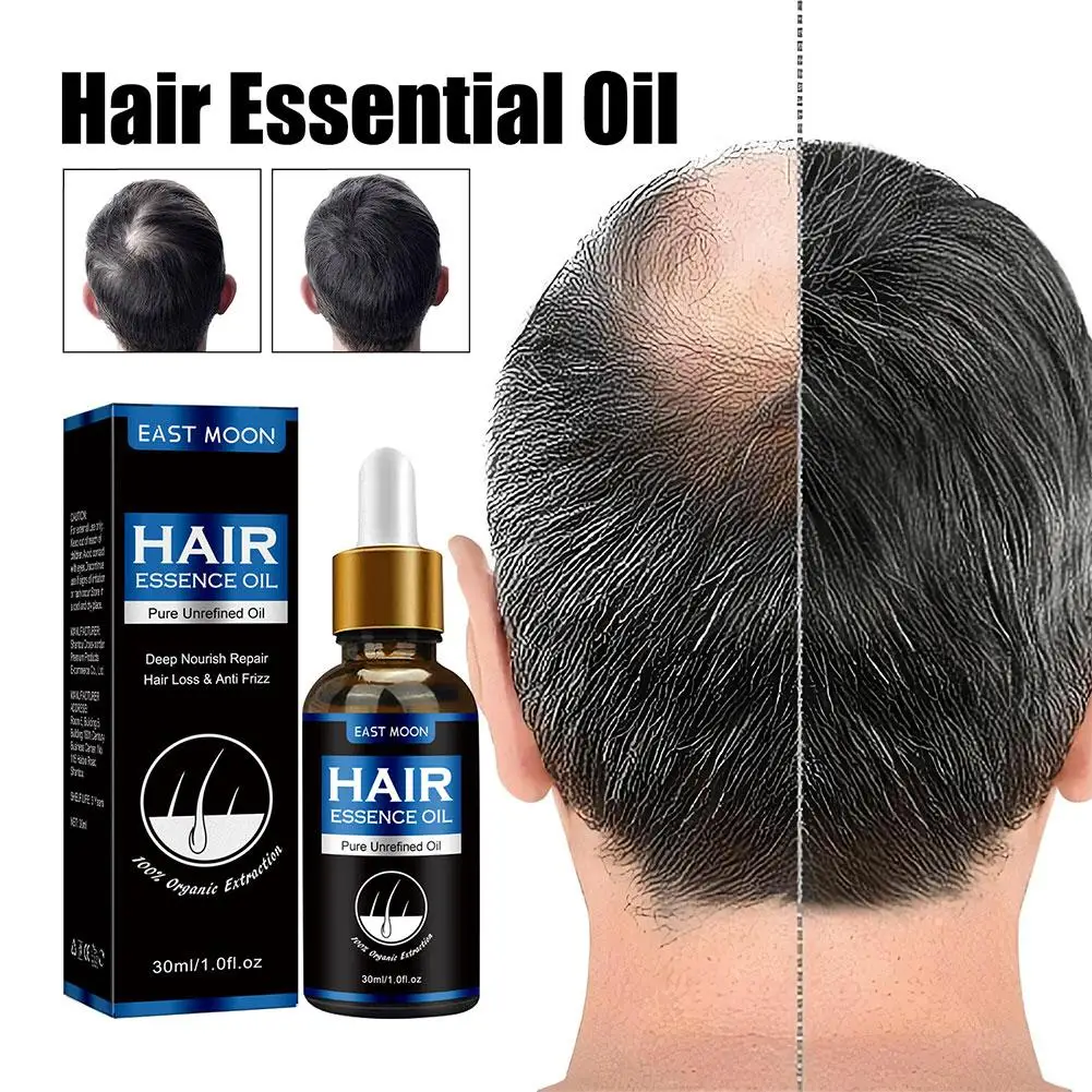 Ginger Hair Care Essential Oil 1-5x 30ml Improves Scalp Environment Hair Loss Treatment Care Essence Oil Gifts