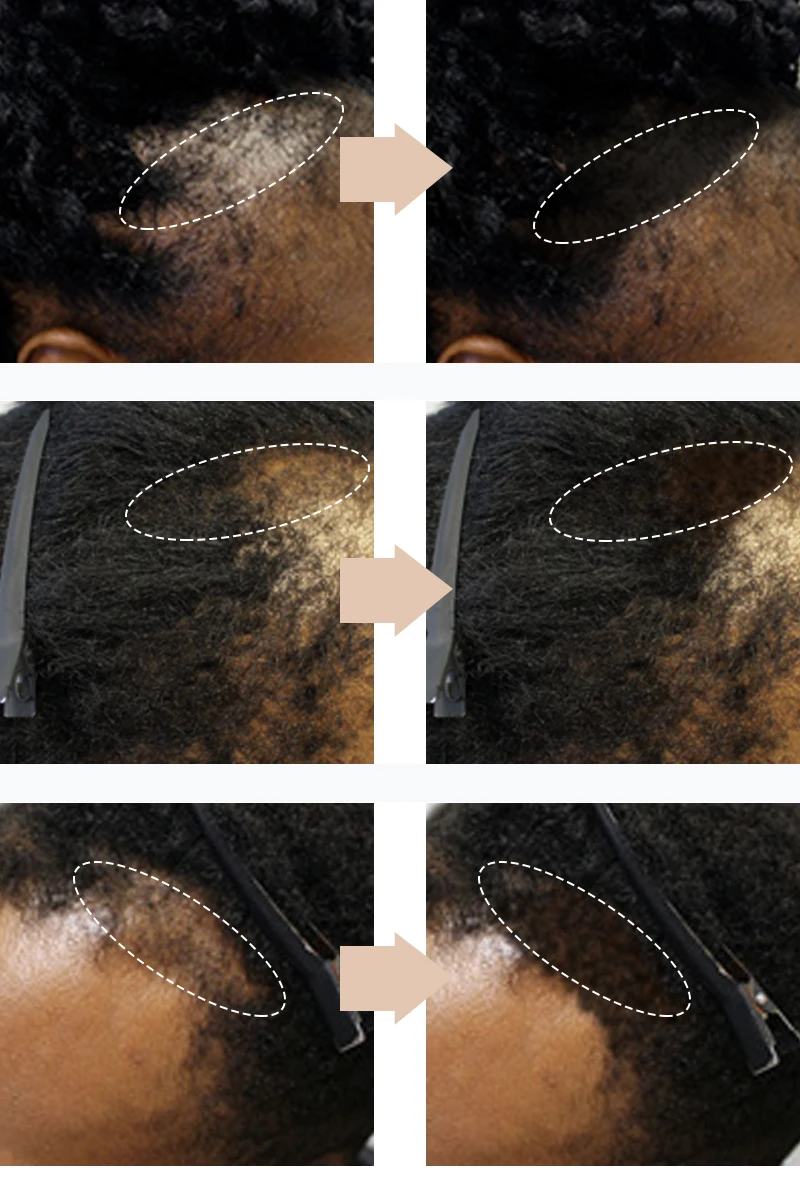 Hair Building Powder 4g for Concealing Hair Loss
