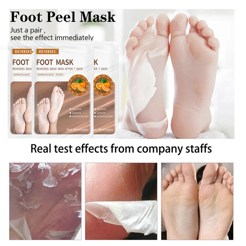 https://ae01.alicdn.com/kf/S6235563a2ebb42668a76b4be2881463c4/HEMEIEL-Whitening-Foot-Peeling-Mask-Heel-Cracks-Repair-Exfoliating-Pedicure-Socks-Dead-Skin-Remover-Peel-Off.jpg