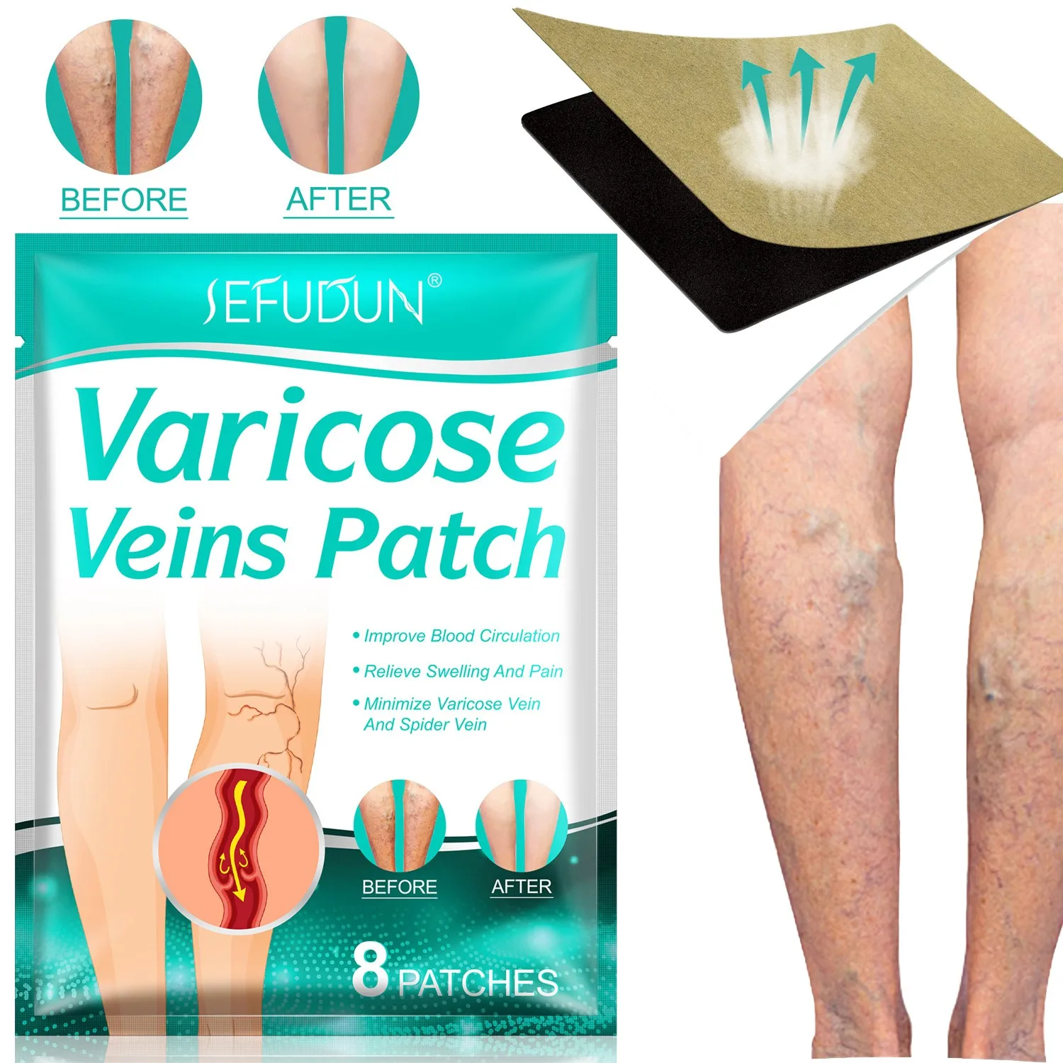 Varicose Veins Patch Relief Leg Vasculitis Spider Varicose Vein Patches