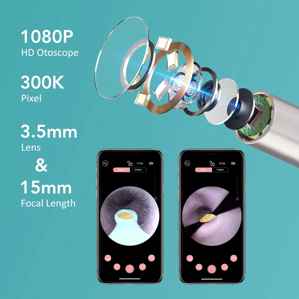 스마트 비주얼 귀지 제거기 카메라 포함 귀지 제거 도구 키트 2-in-1 귀이개 & 핀셋 HD 내시경 귀지 제거기