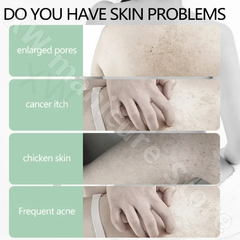 Anti-mite Shower Gel Improves Chicken Skin Texture Deep Cleanses and Brightens Skin Tone Shower Gel for Men and Women 400ml