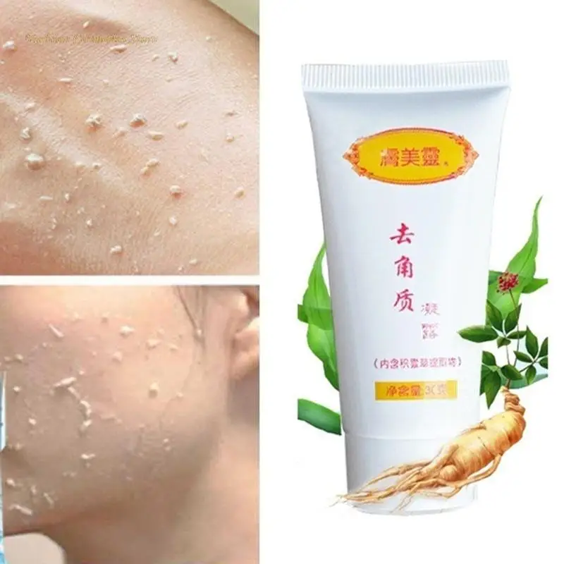 30g Peeling Gel Facial Exfoliating Peeling Lotion Scrub Deep Clean Acne Blackhead Remove Face Cleanser Whitening Oil Control