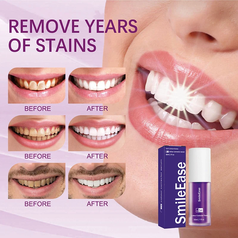 Tooth Cleansing Mousse Purple Bottled Press Toothpaste Refreshes Breath Whitens Teeth Stains Stains Removal Dental Cleansing 2