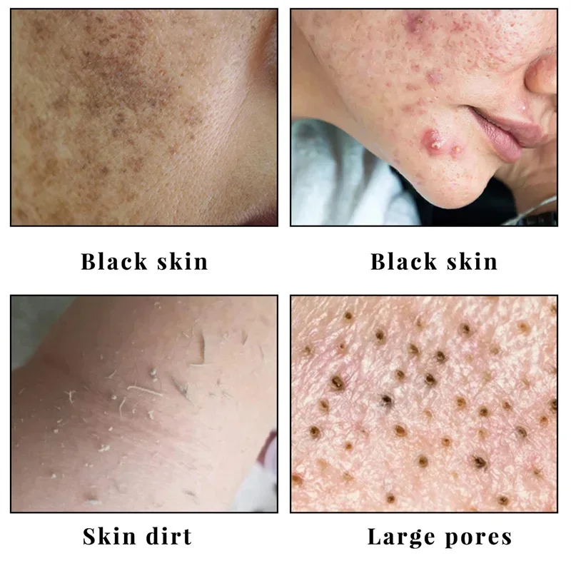 Body Whitening Soap Underarm Knee Bleaching