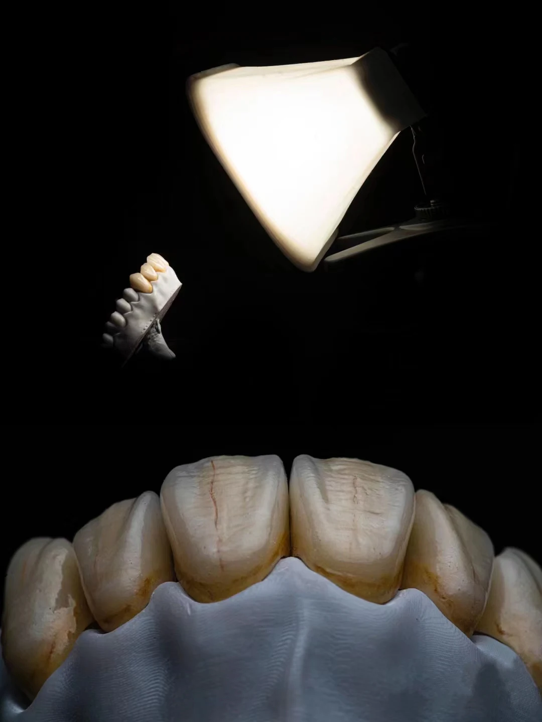 Double Flash Soft Light Studio Clinical Oral Black and White Background Tooth Effect Picture Macro Stack Lighting Shooting