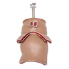 Anatomy Model Human Rectal Hemorrhoid Lesion Model Hemorrhoid Fistula Fistula Fissure Pathology Teaching Model 6