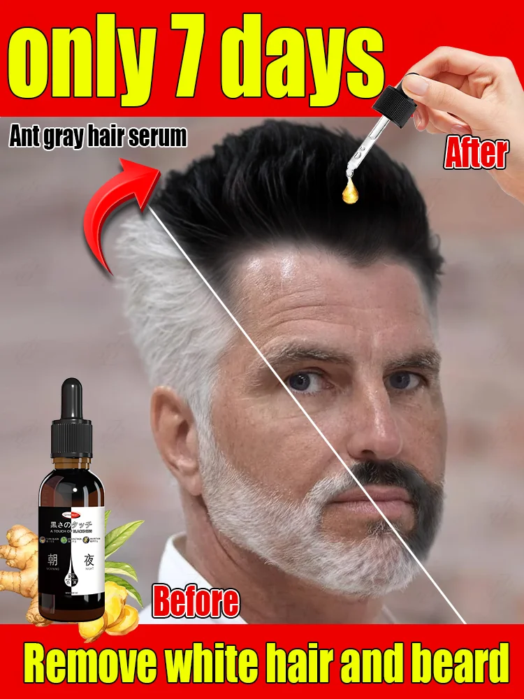 Hair Oil Hair Essence Oil Natural Anti-Gray Hair Serum 7-Day Dark Hair Restoration & 98% Gray Prevention-Root Repair with Botanical Extract