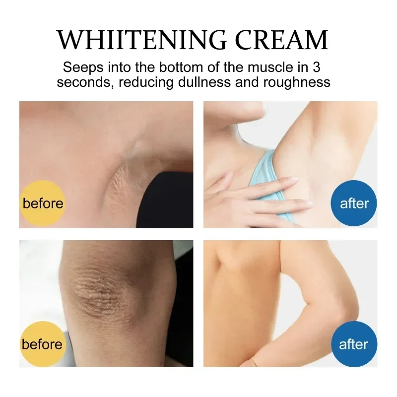 Skin whitening cream armpit Knee Neck removal dark Spots Melanin Bleaching Underarm Inner Thigh brighten moisturizing body care