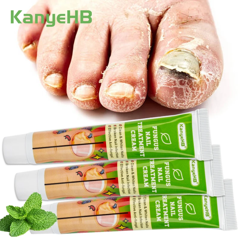 Antibacterial Anti Fungal Cream 3Pcs Fungal Nail Repair Cream Chinese Medical Foot Toe Nail Anti Infection Care Ointment