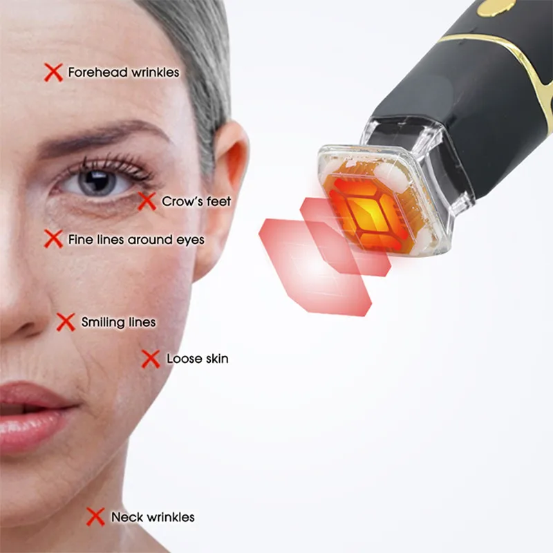 Portable RF Thermal Lifting Tightening Machine cellulite removal High Frequency Radio Anti Wrinkle Aging Skin Rejuvenation Tool 5