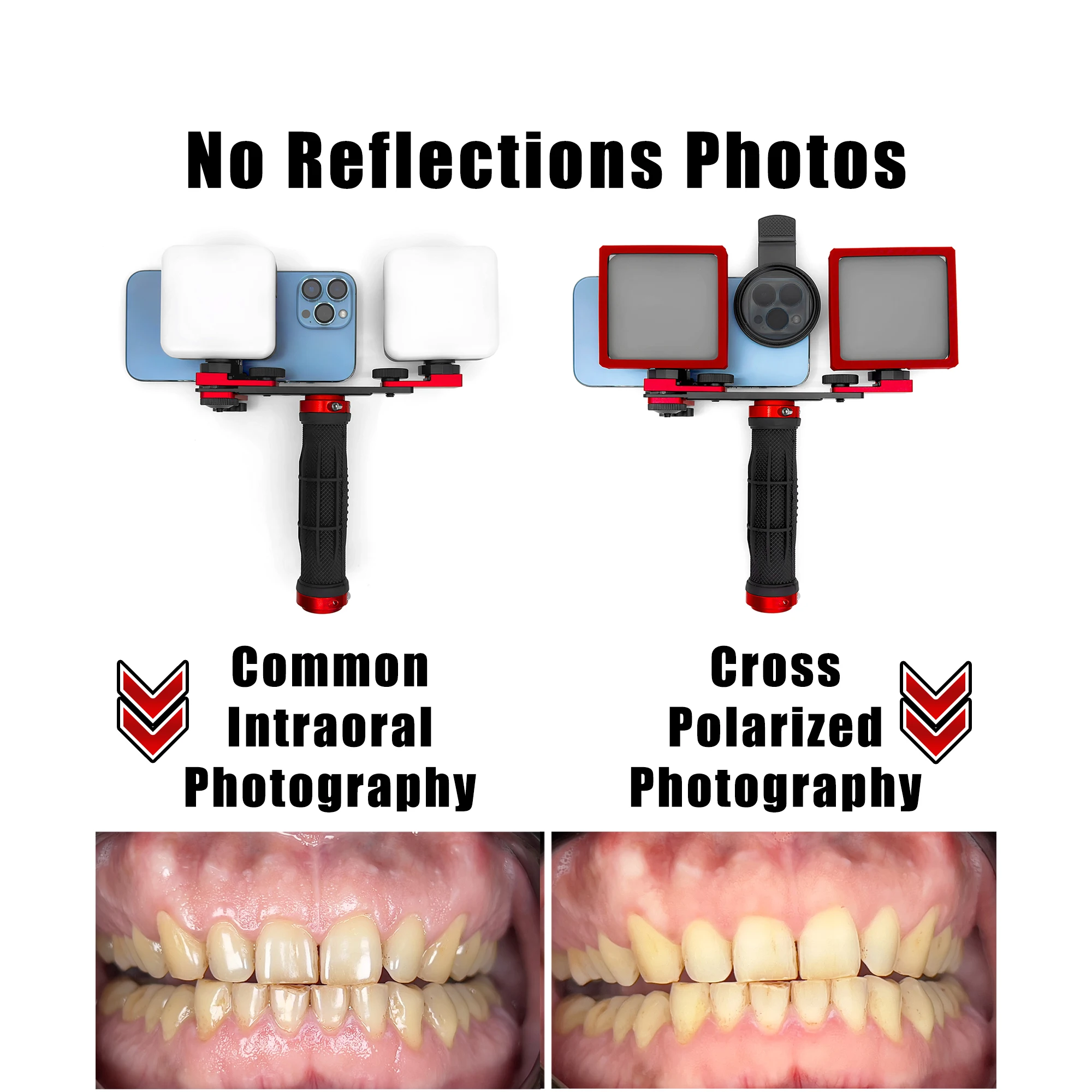 Canon Camera Settings Best Camera For Dental Photography