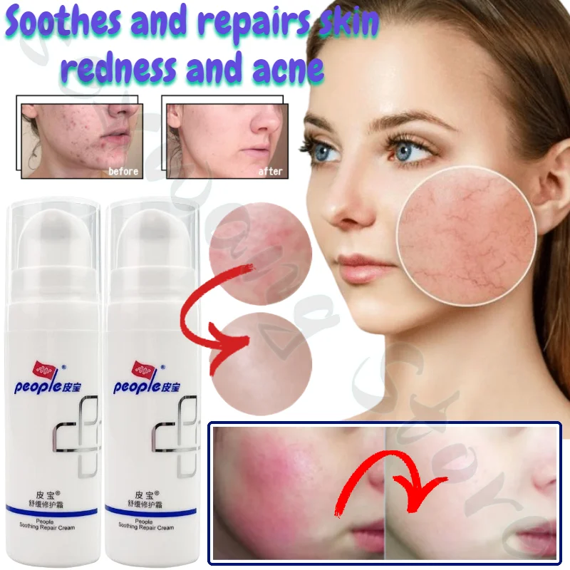 people soothing repair cream 50g facial cream emulsion sensitivity redness hydration moisturising high quality skin care product People Soothing Special Care Cream Oil Sensitive Skin Repair Skin Barrier Moisturizing Hydration Repair Acne Skin Redness Acne