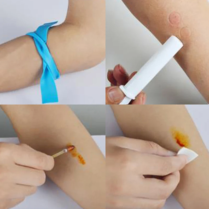Natural Detoxifier Bed Bug Bee Wasp Insect Sting Sucker Relieve Pain Outdoor First Aid Survival Tool Venom Extractor
