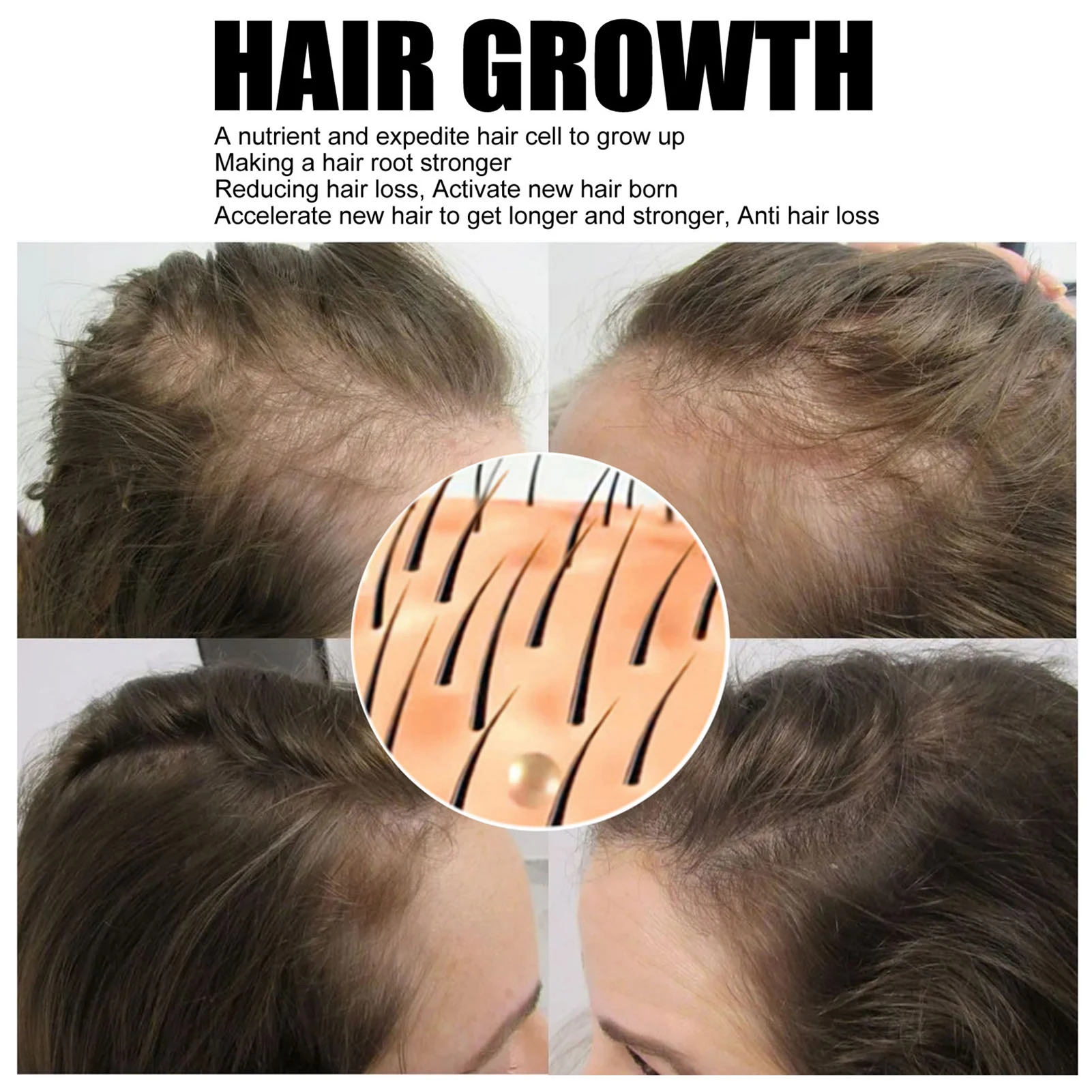 Hair Growth Essence Spray Herbal-essence For Hair Grower Hair Loss Serum  Nourish Roots Fast Germinal Hair Care For Men - Hair Care Product Sets -  AliExpress