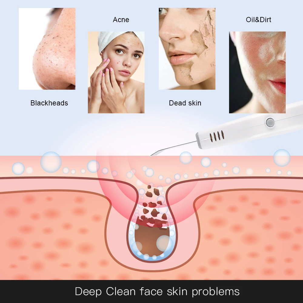 Facial Scrubber Ultrasonic Facial Skin Scrubber Deep Cleaning Blackhead Acne Spots Remover Peeling Beauty