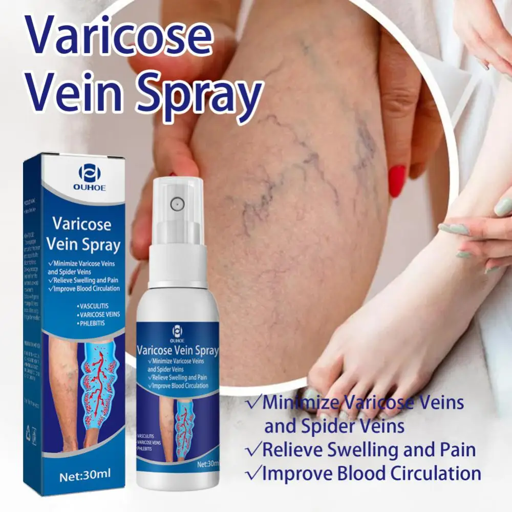 

Varicose Veins Treatment Spray Repair Leg Blood Vessels Bulge Redness Vasculitis Phlebitis Pain Relieve Vein Healing Spray