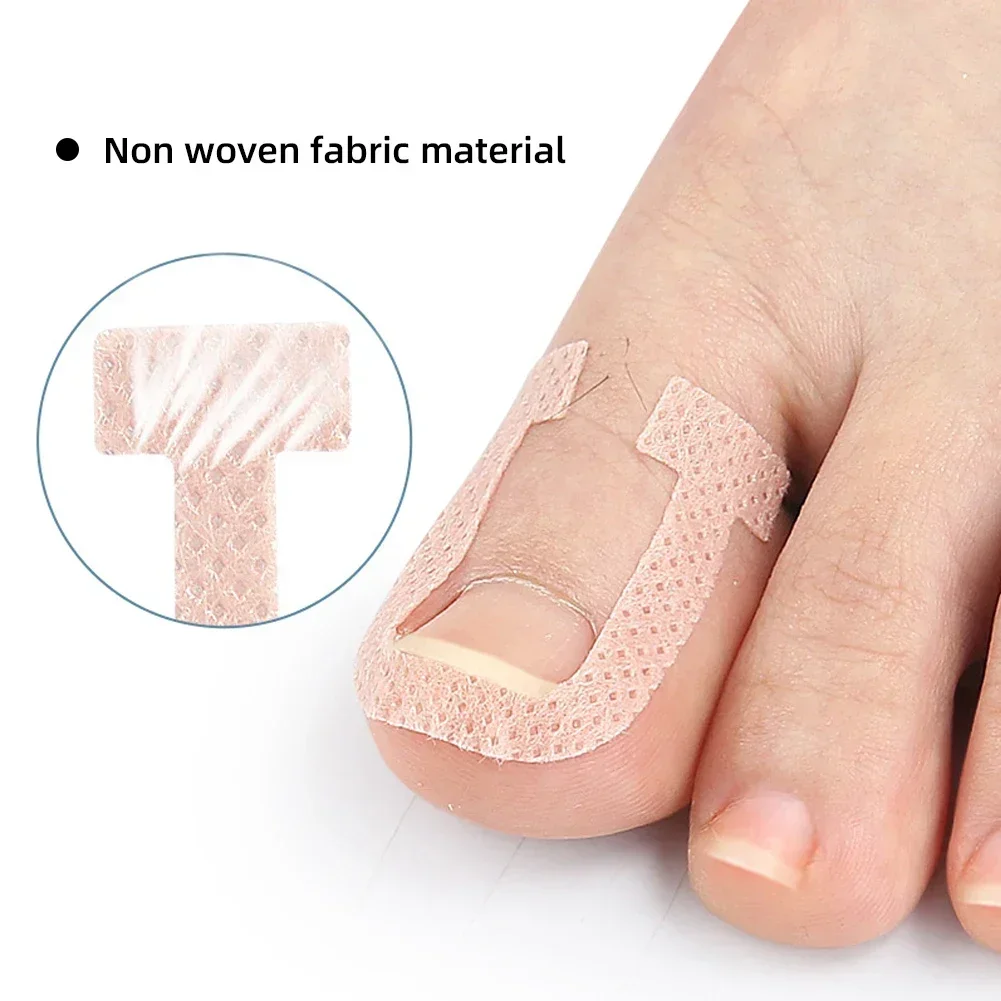 Nail Correction Stickers Ingrown Toenail Corrector Patches Treatment Recover Corrector Pedicure Care Tool 4Pcs/Sheet