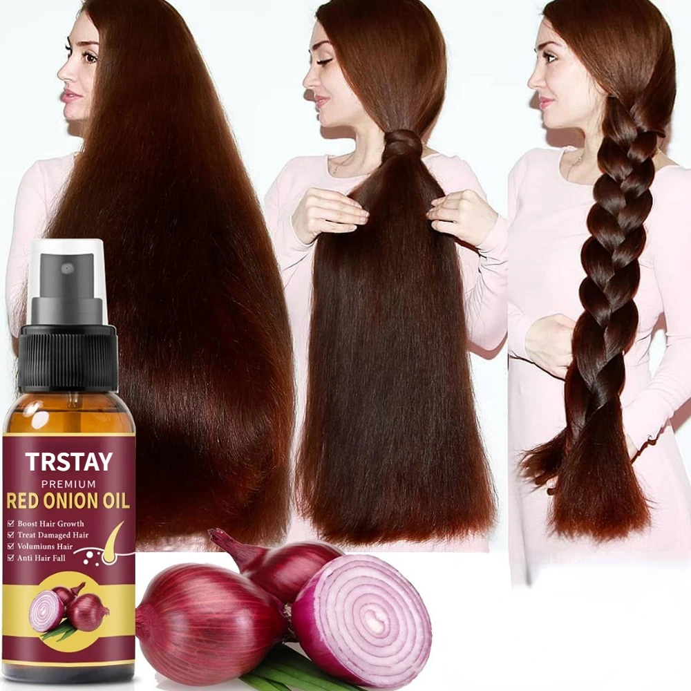 Hair Grouth Fast Onion Black Seed Essential Oils Oil Spray for Hair