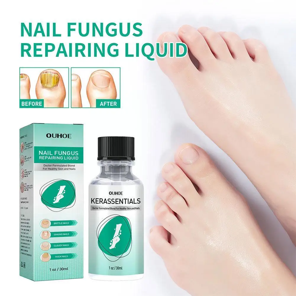 Repairing Oil For Nails Safe Nail Strengthening Lotion Nail Growth