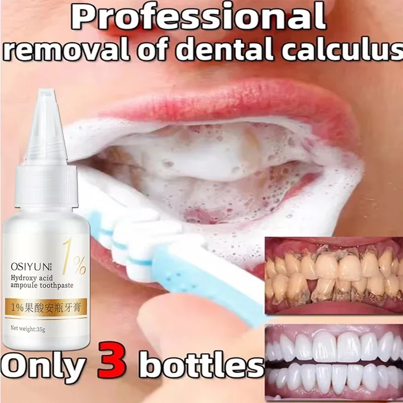 Teeth Whitening Toothpaste Fruit Acid Remove Plaque Stains Calculus Fresh Breath Cleaning Oral Hygiene Dental Bleach Care Tools teeth whitening product teeth whitening essence teeth health product