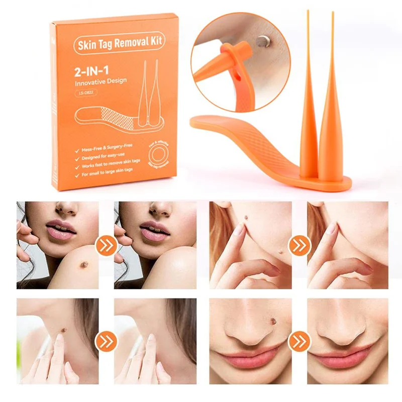 

2 IN 1 Skin Tag Removal Kit Body Face Meat Cellulite Micro Mole Wart Removal Tool For Face Skin Care Micro Meat Cubes Removal