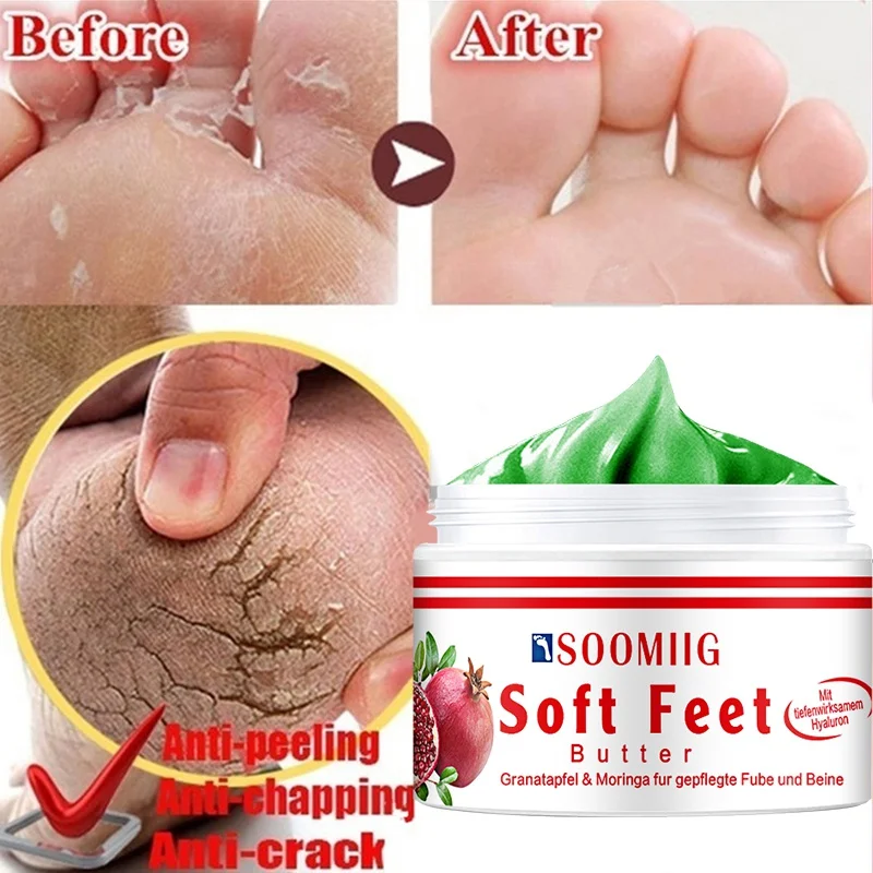 

Soomiig Repairing Hand Cream - Prevents Skin Swelling and Dryness of Hands, Feet, Legs, Nourishes Skin, Smoothes Fine Lines