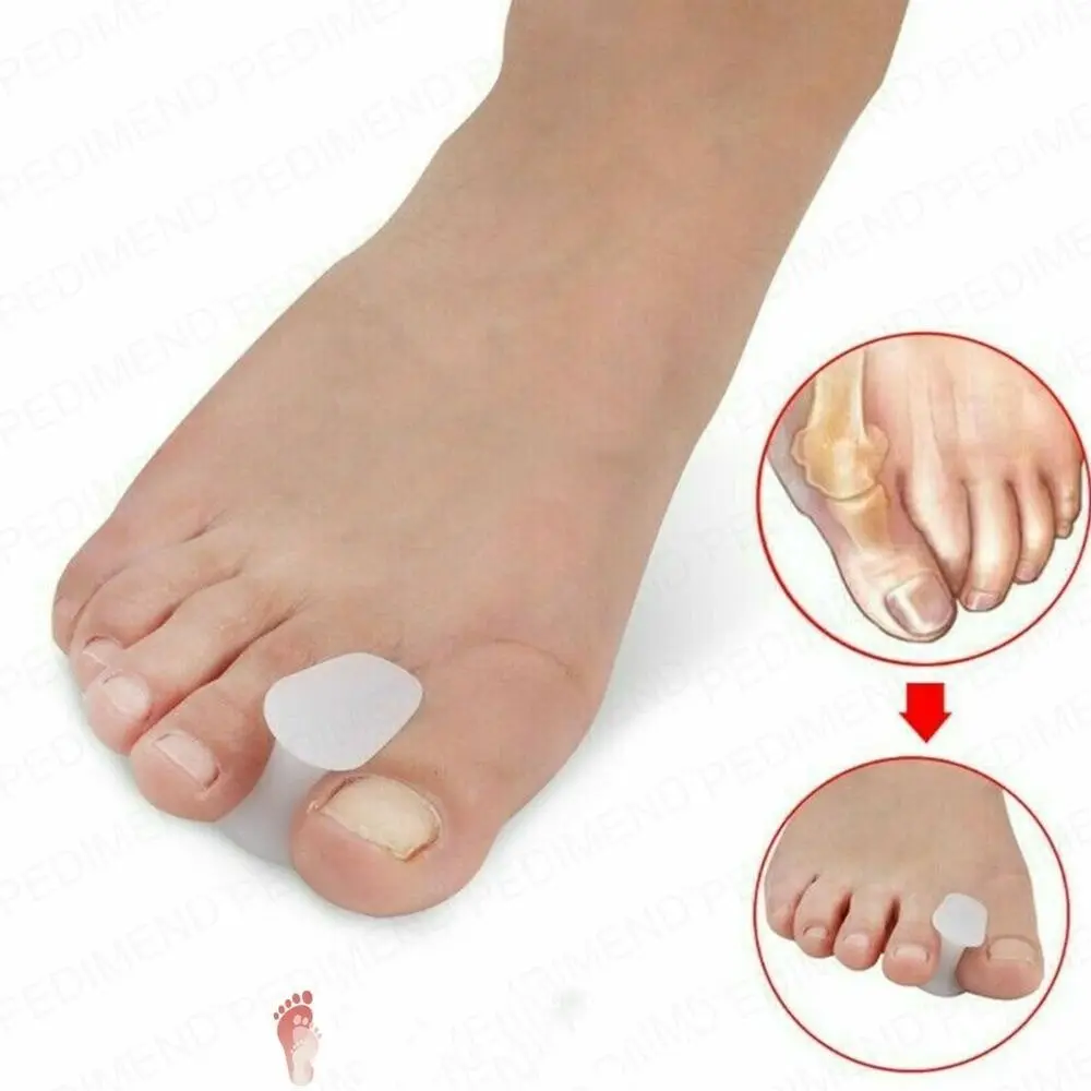 

Гелевый разветвитель для пальцев ног унисекс, удобный разветвитель для пальцев ног для мужчин и женщин