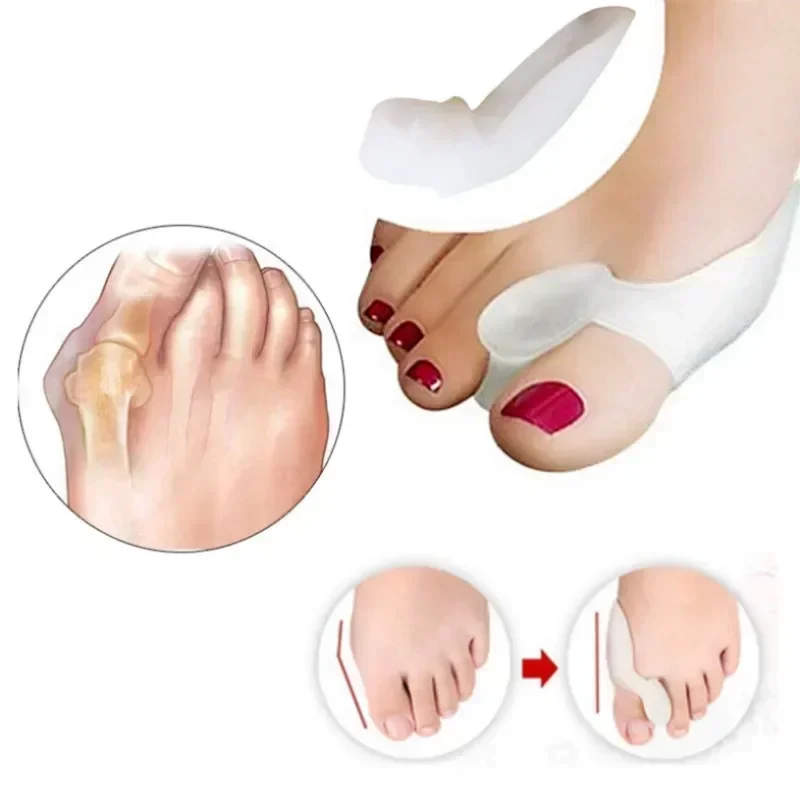 Bunion Foot Toe Hallux Valgus Protector Silicone 2PCS Gel Thumb Corrector Separator Finger Straightener Adjuster Foot Care Tool